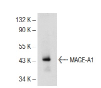  MAGE-A1 (3F256): sc-71539. Western blot analysis of MAGE-A1 expression in A-375 whole cell lysate.