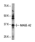  MAGE-A2 (133AT1218): sc-130164. Western blot analysis of MAGE-A2 expression in HL60 whole cell lysate.