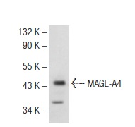  MAGE-A4 (C-13): sc-28484. Western blot analysis of MAGE-A4 expression in A-375 whole cell lysate.