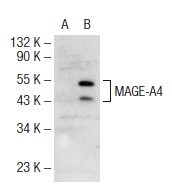  MAGE-A4 (C-13): sc-28484. Western blot analysis of MAGE-A4 expression in non-transfected: sc-117752 (A) and human MAGE-A4 transfected: sc-176182 (B) 293T whole cell lysates.