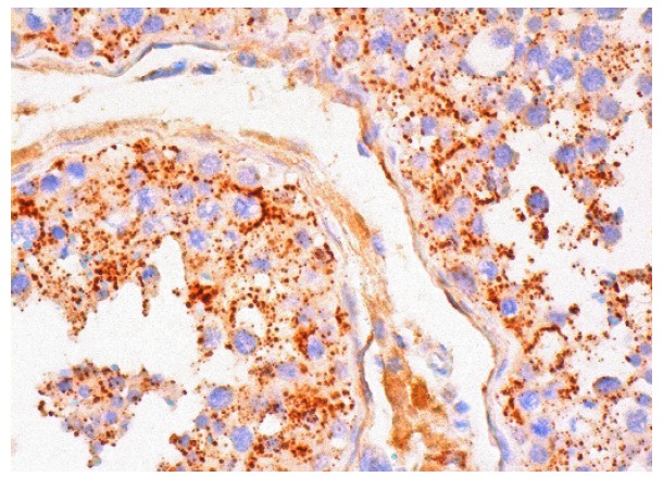  MAGE-A3/6 (C-13): sc-33234. Immunoperoxidase staining of formalin fixed, paraffin-embedded human testis tissue showing cytoplasmic staining of cells in seminiferous ducts and Leydig cells.