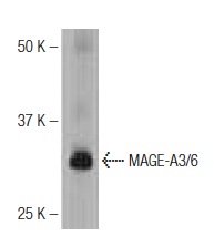  MAGE-A3/6 (G-23): sc-130810. Western blot analysis of MAGE-A3/6 expression in A549 whole cell lysate.