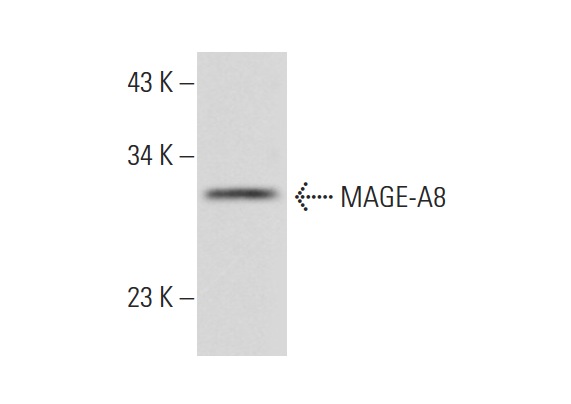  MAGE-A8 (T-14): sc-132331. Western blot analysis of MAGE-A8 expression in human spleen tissue extract.