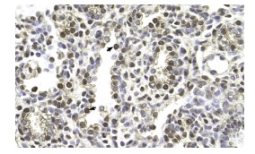  MAGE-A8 (V-25): sc-102016. Immunoperoxidase staining of formalin fixed, paraffin-embedded human lung tissue showing nuclear and cytoplasmic staining.