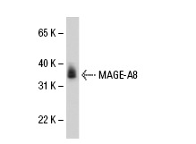  MAGE-A8 (V-25): sc-102016. Western blot analysis of MAGE-A8 expression in placenta tissue extract.