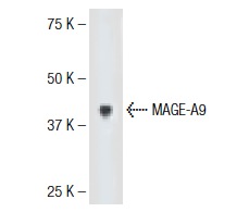  MAGE-A9 (G-24): sc-130811. Western blot analysis of MAGE-A9 expression in human placenta tissue extract.