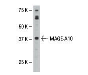  MAGE-A10 (C-23): sc-130161. Western blot analysis of MAGE-A10 expression in HL60 whole cell lysate.