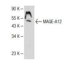  MAGE-A12 (N-17): sc-130163. Western blot analysis of MAGE expression in Jurkat whole cell lysate.