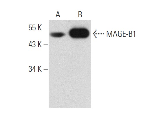  MAGE-B1 (B-4): sc-271008. Western blot analysis of MAGE-B1 expression in non-transfected: sc-117752 (A) and human MAGE-B1 transfected: sc-113270 (B) 293T whole cell lysates.