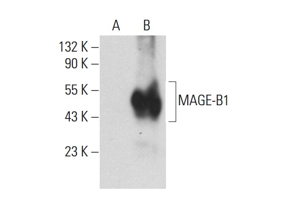  MAGE-B1 (B-9): sc-166954. Western blot analysis of MAGE-B1 expression in non-transfected: sc-117752 (A) and human MAGE-B1 transfected: sc-113270 (B) 293T whole cell lysates.