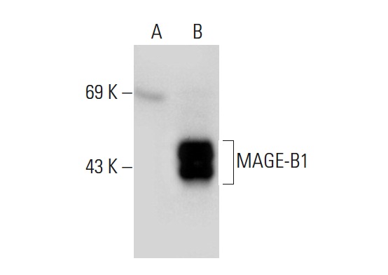  MAGE-B1 (B-9): sc-166954. Western blot analysis of MAGE-B1 expression in non-transfected: sc-117752 (A) and human MAGE-B1 transfected: sc-176733 (B) 293T whole cell lysates.