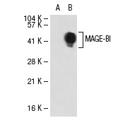  MAGE-B1 (E-19): sc-14294. Western blot analysis of MAGE-B1 expression in non-transfected: sc-117752 (A) and human MAGE-B1 transfected: sc-113270 (B) 293T whole cell lysates.