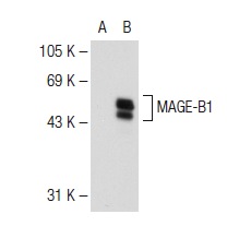  MAGE-B1 (E-19): sc-14294. Western blot analysis of MAGE-B1 expression in non-transfected: sc-117752 (A) and human MAGE-B1 transfected: sc-176733 (B) 293T whole cell lysates.