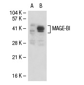  MAGE-B1 (E-15): sc-14295. Western blot analysis of MAGE-B1 expression in non-transfected: sc-117752 (A) and human MAGE-B1 transfected: sc-113270 (B) 293T whole cell lysates.