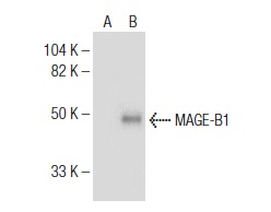  MAGE-B1 (H-40): sc-292563. Western blot analysis of MAGE-B1 expression in non-transfected: sc-117752 (A) and human MAGE-B1 transfected: sc-113270 (B) 293T whole cell lysates.