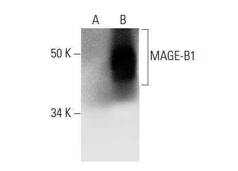  MAGE-B1 (H-40): sc-292563. Western blot analysis of MAGE-B1 expression in non-transfected: sc-117752 (A) and human MAGE-B1 transfected: sc-113270 (B) 293T whole cell lysates.