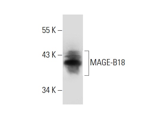  MAGE-B18 (I-12): sc-131175. Western blot analysis of MAGE-B18 expression in MCF7 whole cell lysate.