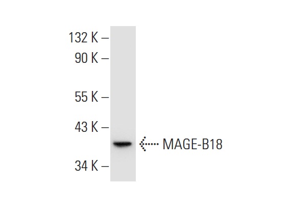  MAGE-B18 (I-12): sc-131175. Western blot analysis of MAGE-B18 expression in A549 whole cell lysate.