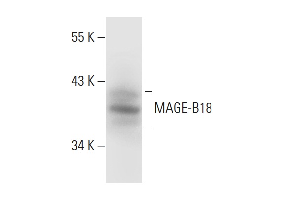  MAGE-B18 (N-13): sc-131177. Western blot analysis of MAGE-B18 expression in MCF7 whole cell lysate.