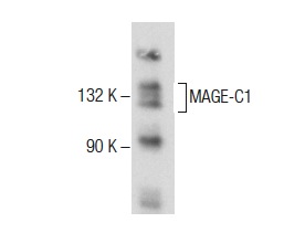  MAGE-C1 (F-2): sc-377473. Western blot analysis of MAGE-C1 expression in SK-MEL-28 whole cell lysate.