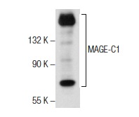  MAGE-C1 (F-2): sc-377473. Western blot analysis of MAGE-C1 expression in U266 nuclear extract.