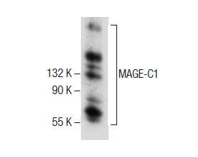  MAGE-C1 (E-5): sc-377493. Western blot analysis of MAGE-C1 expression in SK-MEL-28 whole cell lysate.