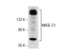  MAGE-C1 (E-5): sc-377493. Western blot analysis of MAGE-C1 expression in U266 nuclear extract.