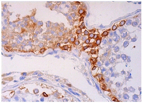  MAGE-C1 (E-5): sc-377493. Immunoperoxidase staining of formalin fixed, paraffin-embedded human testis tissue showing cytoplasmic and membrane staining of cells in seminiferous ducts.