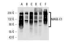  MAGE-C1 (CT7-33): sc-53868. Western blot analysis of MAGE-C1 expression in human testis tissue extract (A) and Hs 294T (B), SK-MEL-28 (C), U-87 MG (D) and JEG-3 (E) whole cell lysates and U266 nuclear extract (F).