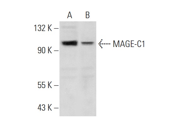  MAGE-C1 (L-20): sc-68599. Western blot analysis of MAGE-C1 expression in K-562 (A) and Jurkat (B) whole cell lysates.