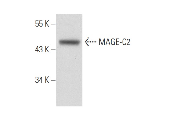  MAGE-C2 (K-15): sc-68603. Western blot analysis of MAGE-C2 expression in 293T whole cell lysate.