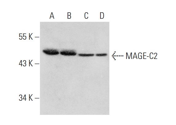  MAGE-C2 (K-15): sc-68603. Western blot analysis of MAGE-C2 expression in U-698-M (A), HeLa (B), Jurkat (C) and K-562 (D) whole cell lysates.