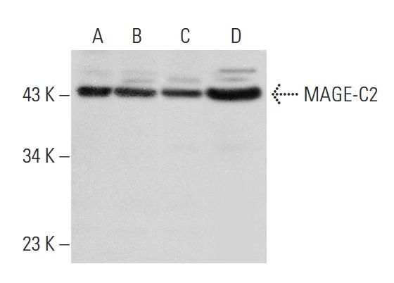  MAGE-C2 (V-20): sc-68605. Western blot analysis of MAGE-C2 expression in K-562 (A), Hep G2 (B), A431 (C) and MDA-MB-231 (D) whole cell lysates.