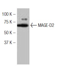  MAGE-D2 (FW.6): sc-130443. Western blot analysis of MAGE-D2 expression in MCF7 whole cell lysate.