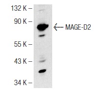  MAGE-D2 (FW.6): sc-130443. Western blot analysis of MAGE-D2 expression in HeLa whole cell lysate.