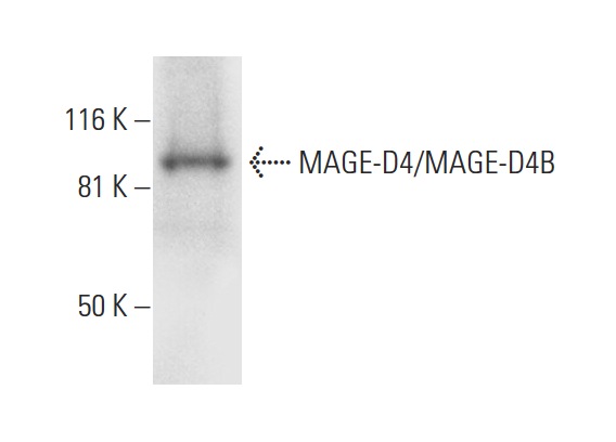  MAGE-D4/MAGE-D4B (E-7): sc-393203. Western blot analysis of MAGE-D4/MAGE-D4B expression in human hippocampus tissue extract.