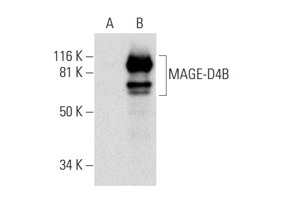  MAGE-D4/MAGE-D4B (E-7): sc-393203. Western blot analysis of MAGE-D4B expression in non-transfected: sc-117752 (A) and human MAGE-D4B transfected: sc-369074 (B) 293T whole cell lysates.