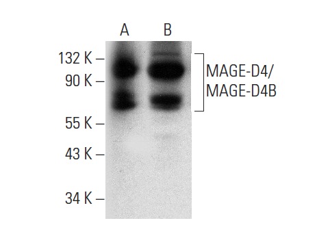  MAGE-D4/MAGE-D4B (E-7): sc-393203. Western blot analysis of MAGE-D4/MAGE-D4B expression in human lateral ventricle tissue extract (A) and SH-SY5Y whole cell lysate (B).