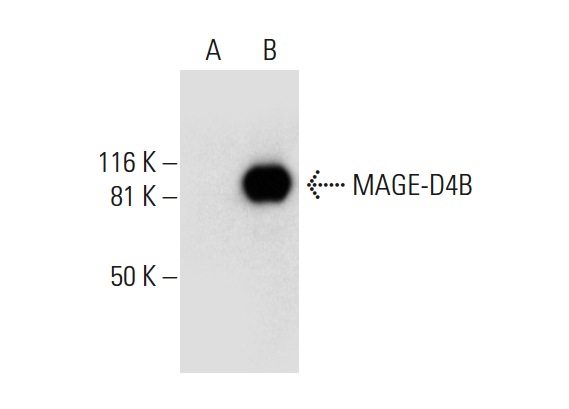  MAGE-D4/MAGE-D4B (F-9): sc-393058. Western blot analysis of MAGE-D4B expression in non-transfected: sc-117752 (A) and human MAGE-D4B transfected: sc-369074 (B) 293T whole cell lysates.