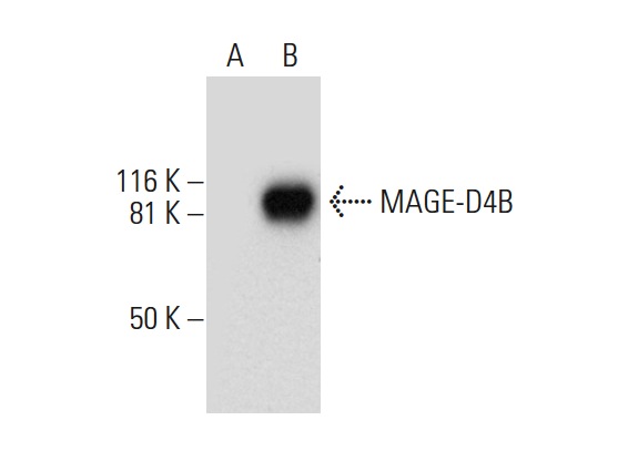  MAGE-D4/MAGE-D4B (G-12): sc-393059. Western blot analysis of MAGE-D4B expression in non-transfected: sc-117752 (A) and human MAGE-D4B transfected: sc-369074 (B) 293T whole cell lysates.