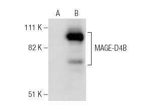  MAGE-D4/MAGE-D4B (H-188): sc-68851. Western blot analysis of MAGE-D4B expression in non-transfected: sc-117752 (A) and human MAGE-D4B transfected: sc-369074 (B) 293T whole cell lysates.