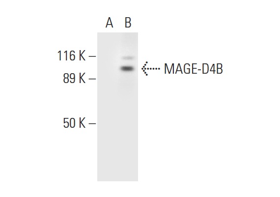  MAGE-D4/MAGE-D4B (H-9): sc-390918. Western blot analysis of MAGE-D4B expression in non-transfected: sc-117752 (A) and human MAGE-D4B transfected: sc-369074 (B) 293T whole cell lysates.