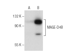  MAGE-D4/MAGE-D4B (T-20): sc-68613. Western blot analysis of MAGE-D4B expression in non-transfected: sc-117752 (A) and human MAGE-D4B transfected: sc-369074 (B) 293T whole cell lysates.