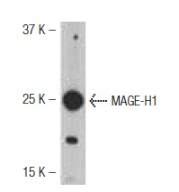  MAGE-H1 (H-21): sc-130813. Western blot analysis of MAGE-H1 expression in Jurkat whole cell lysate.