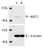  MALT1 siRNA (h): sc-35845. Western blot analysis of MALT1 expression in non-transfected control (A) and MALT1 siRNA transfected (B) HeLa cells. Blot probed with MALT1 (C-16): sc-20553. α-actinin (H-2): sc-17829 used as specificity and loading control.