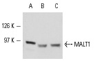  MALT1 (C-16): sc-20553. Western blot analysis of MALT1 expression in Jurkat (A), Daudi (B) and RAW 264.7 (C) whole cell lysates.