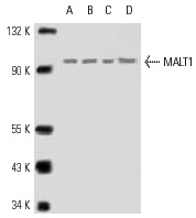  MALT1 (E-13): sc-20552. Western blot analysis of MALT1 expression in Jurkat (A), Daudi (B), RAW 264.7 (C) and IB4 (D) whole cell lysates.