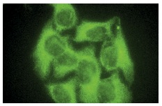  MALT1 (H-300): sc-28246. Immunofluorescence staining of methanol-fixed HeLa cells showing cytoplasmic localization.