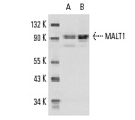  MALT1 (H-300): sc-28246. Western blot analysis of MALT1 expression in Daudi (A) and HeLa (B) whole cell lysates.