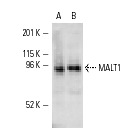  MALT1 (B-12): sc-46677. Western blot analysis of MALT1 expression in Jurkat (A) and Daudi (B) whole cell lysates.